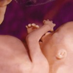 Fetus