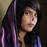 1-1252a686e1 Bibi Aisha, the teenage wife of a Taliban fighter in Afghanistan. When Bibi tried to get away from her abusive husband, her family caught her, cut off her nose and ears, and left her to die in the mountains.