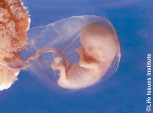 Slide 7: Unborn baby at just 8 weeks