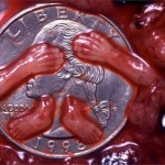 weeks31-9wks