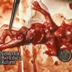 weeks53-10wks