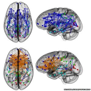 Male brains are wired front to back, with few connections bridging the two hemispheres. In females, the connections criss-cross between left and right