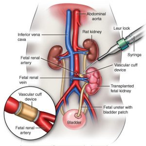 Researchers implant a human fetal kidney into a rat, where the kidney grows until it is fully functioning. Then the rat's original kidneys are removed and the implanted kidney is used to sustain life. 
