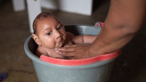 Babies born with microcephaly have abnormally small heads housing an underdeveloped brain. But is Zika to blame?
