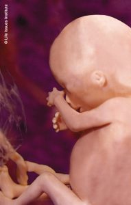 Unborn baby at 16 weeks gestation
